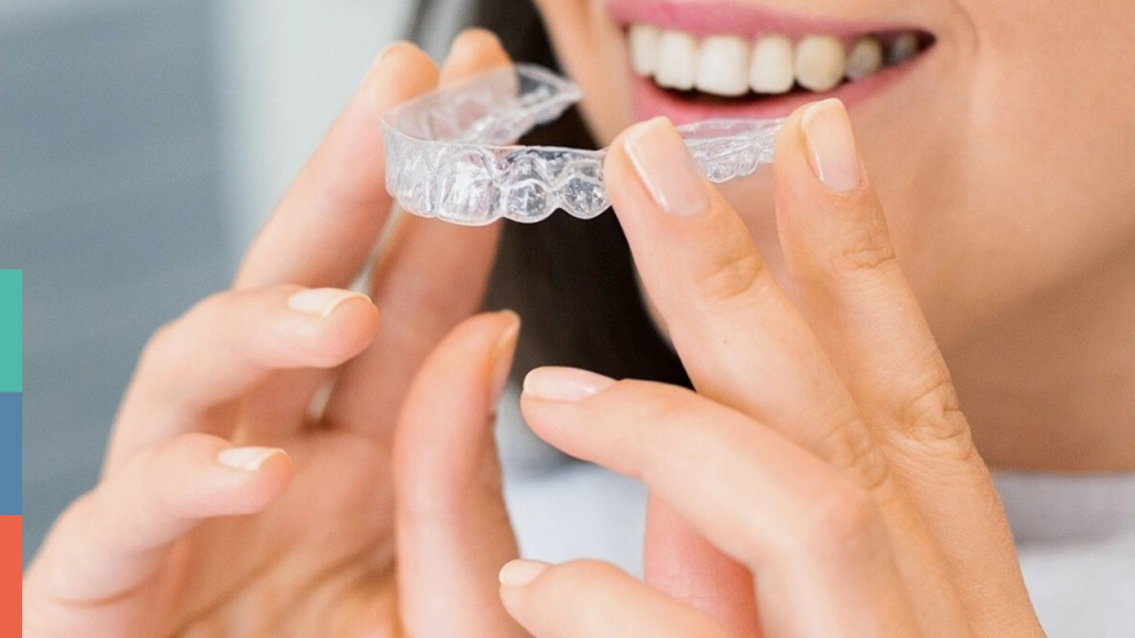 μετά τα σιδεράκια: invisalign σε περίπτωση που ξαναστραβώσουν